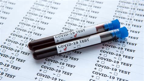 Cum sunt luate testele hormonale pentru diabet